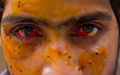 My World is Dark — State Violence and Pellet-firing Shotgun Victims from the 2016 Uprising in Kashmir